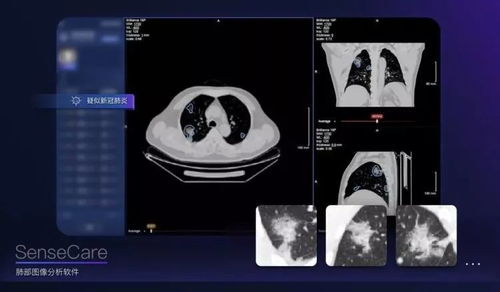 AI戰(zhàn)疫 人工智能在疫情防控中的軟件開發(fā)與應(yīng)用